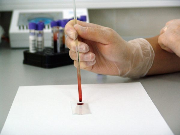 Avoid Costly Errors in Lab Testing: Crucial Tips for Ensuring Accuracy